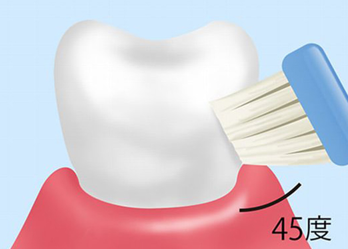 ブラッシングアドバイス